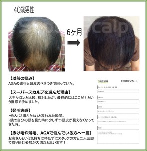 40代　男性　症例です！　ここま…